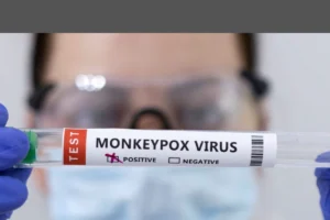 Monkeypox: 13th positive test for monkeypox in India comes from a Nigerian woman in Delhi